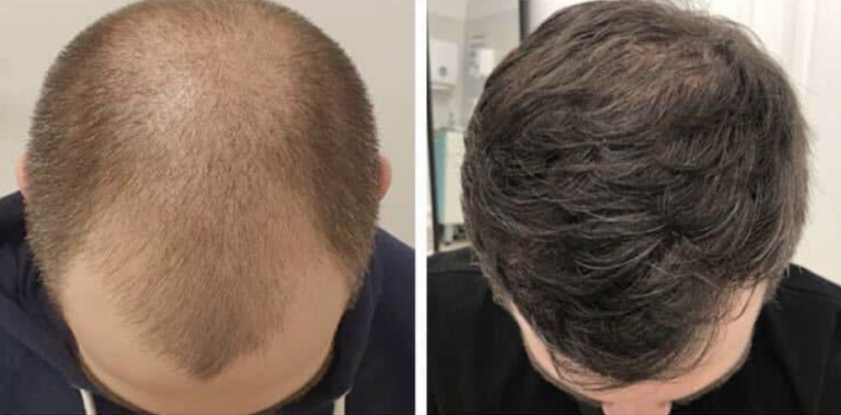 Brume cheveux parfumée : à quoi ça sert et comment l&rsquo;utiliser au Maroc ? (2026)
