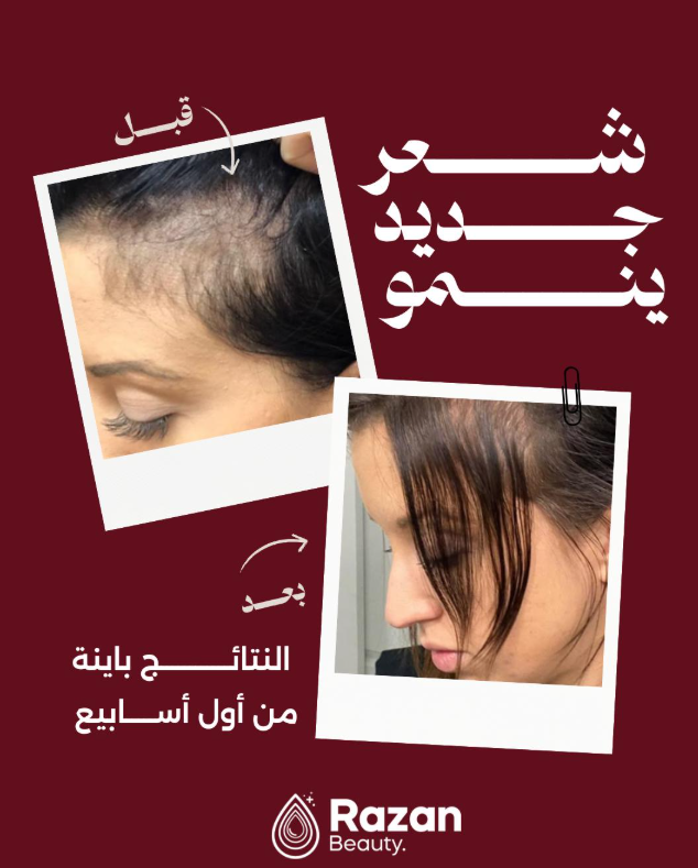 razan-beauty